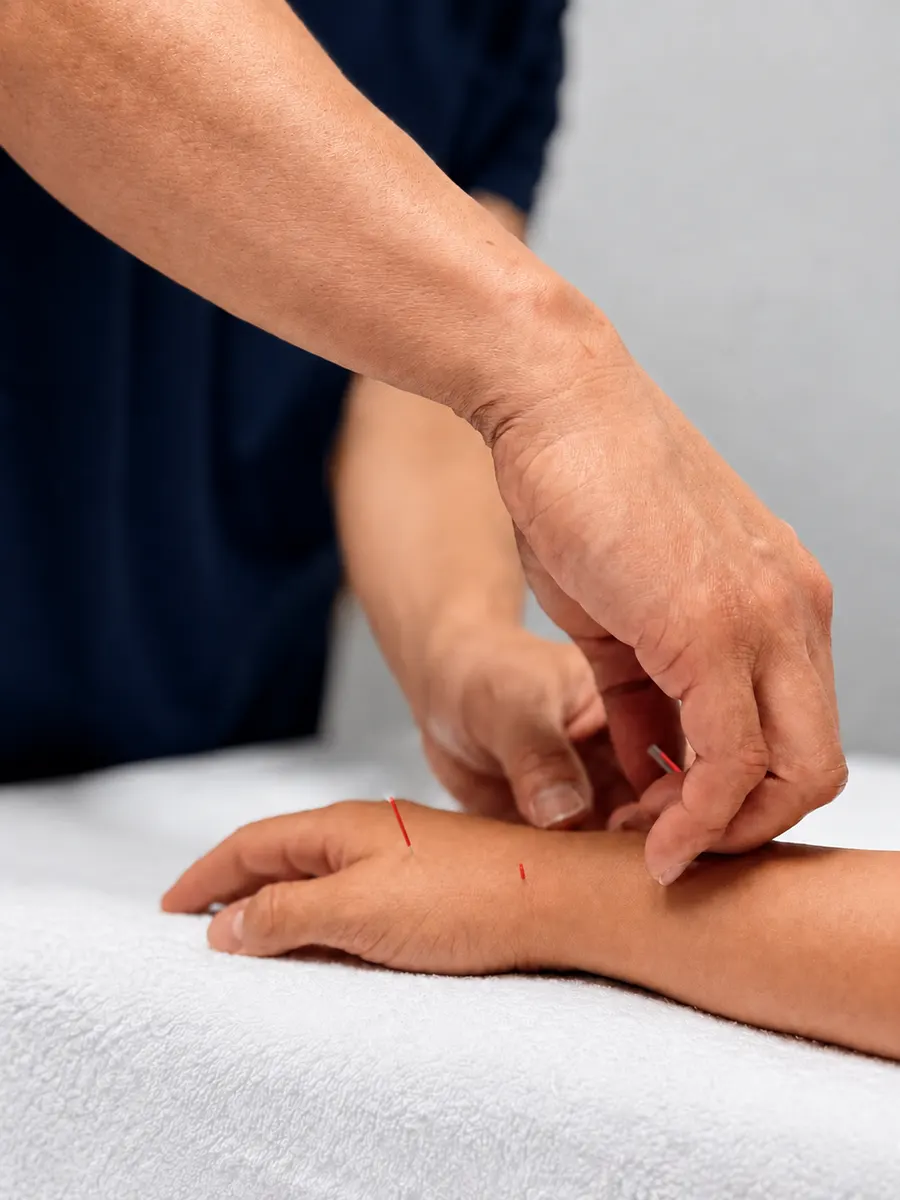 Chiropractic Acupuncture at Adams Chiropractic, Plano TX